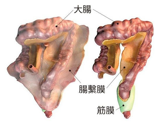 腸 間 膜 脂肪 織 炎