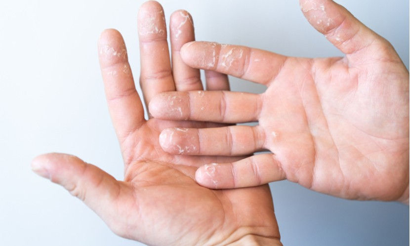 緩解手部乾癢，護手霜怎麼挑？ 專家推7種保濕成分- 康健雜誌
