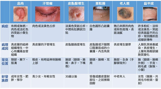 肉芽分6類可以用保養品消除嗎 康健雜誌