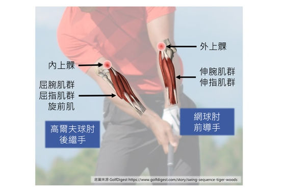 8招預防高爾夫運動傷害國家級隊醫大揭密 康健雜誌