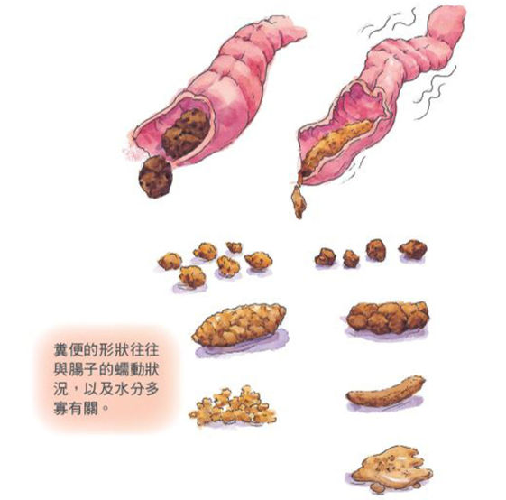 é€™æ¨£åšå°±ä¸æœƒå¾—å¤§è…¸ç™Œå—Ž å°å¤§é†« 9ç¨®å‚³è¨€ä¸å¯ç›¡ä¿¡ åº·å¥é›œèªŒ