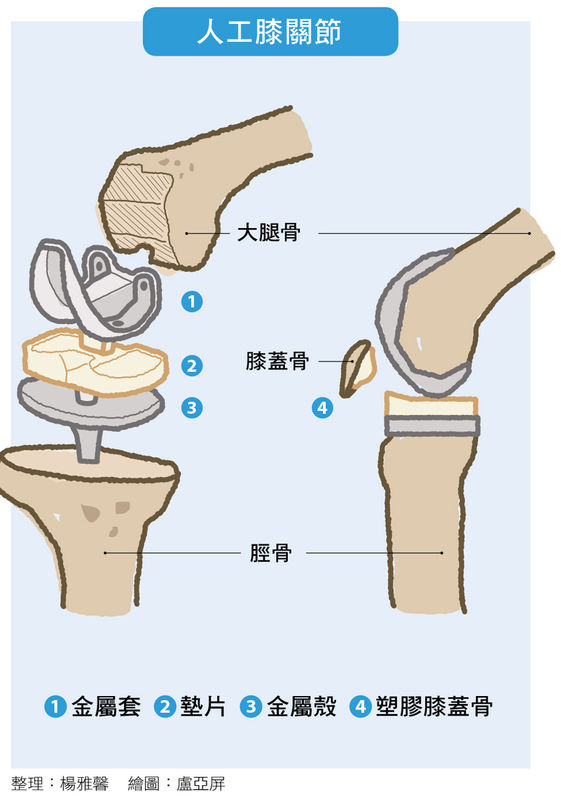 自費就醫指南 骨科 康健雜誌