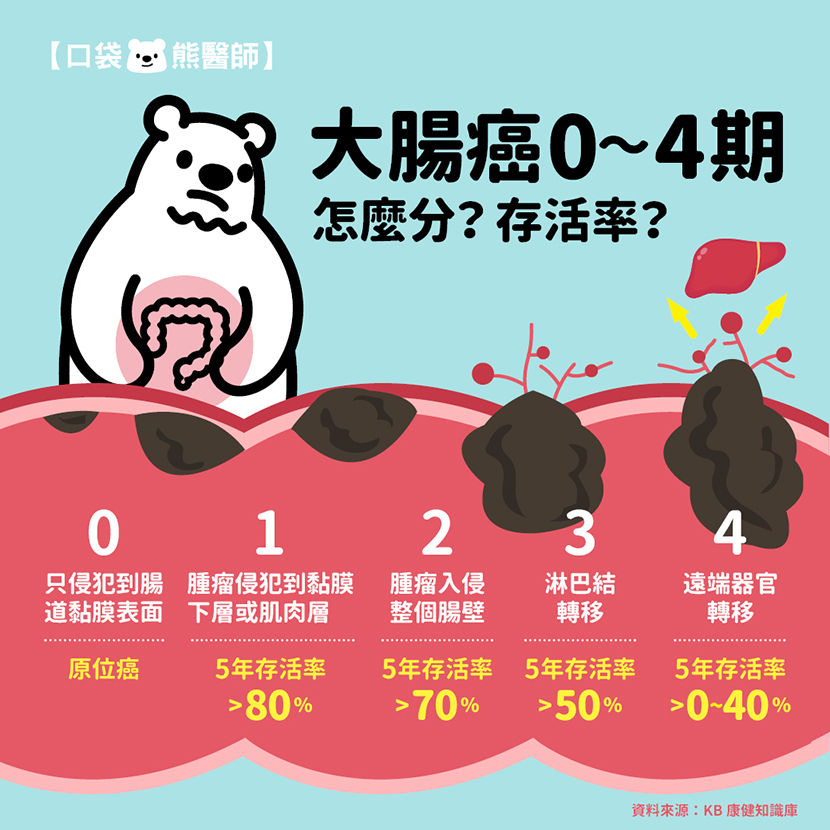大腸癌6大症狀和分期大腸癌預防7招一次說清楚- 康健雜誌