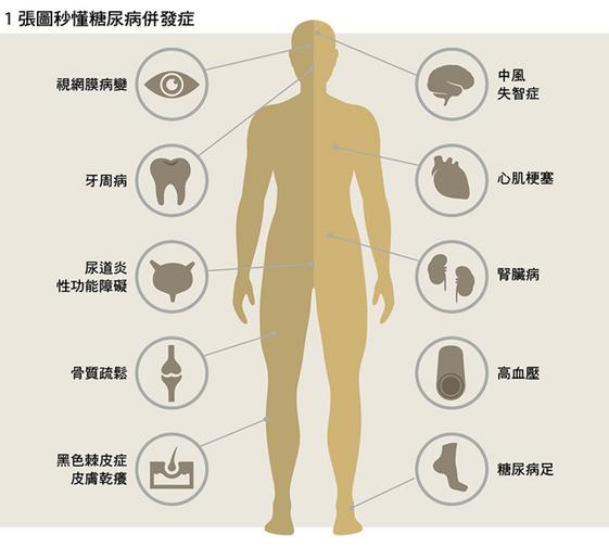 糖尿病是什麼 糖尿病症狀 原因 血糖 治療一次看懂 康健雜誌 糖尿病是什麼 糖尿病症狀 原因 血糖 治療一次看懂 康健雜誌