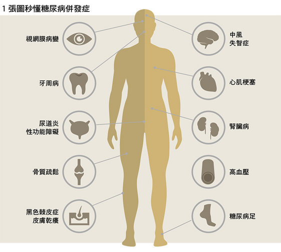 糖尿病是什麼 糖尿病症狀 原因 血糖 治療一次看懂 康健雜誌